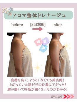 ミトラ(MITRA)/アロマ整体ドレナージュ3回施術