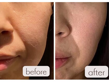 クク 赤坂 天神(99 KUKU)の写真