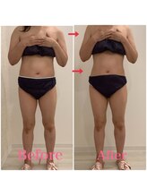 スペチアーレ 夙川/顔もボディもお悩み解決