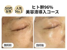 グラツィア(Grazia)/プレミアム！エイジングケア