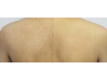 アロマスイーツ(AromaSweets)/本格シェービング/お試しもOK