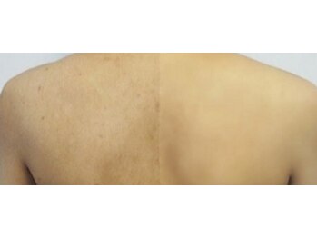 アロマスイーツ(AromaSweets)/本格シェービング/お試しもOK