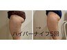 【★最新ハイパーナイフ】下半身集中◎美脚ヒップアップ美尻コース