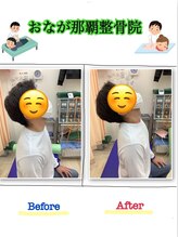 おなが浦添当山整体院/クビ・肩の痛み、可動域改善！