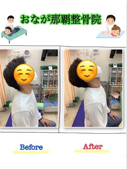 おなが浦添当山整骨院/クビ・肩の痛み、可動域改善!