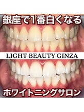 ライトビューティー 銀座店(LightBeauty)/東銀座 ホワイトニング 症例写真