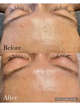 イニ(1n1)/陶肌トリートメント