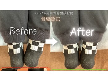 いわくら肩甲骨 骨盤接骨院BTG 一宮千秋/骨盤矯正・足関節矯正 2