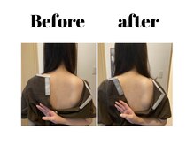 リモド(Rimodo509)/肩甲骨はがし（リンパマッサージ