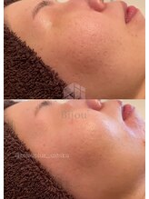 ビジュープラス ひたち野うしく店(Bijou+)/