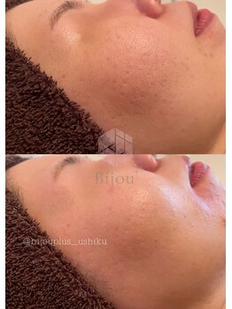 ビジュープラス ひたち野うしく店(Bijou+)/