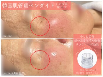 ラ ドゥーサ(La Dusa)/しわ改善/弾力UP◎韓国肌管理