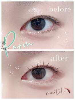 アイル バイ エドゥース(I'LL by et Douce)/メーテルロッド