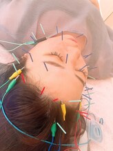 瑞 鍼灸院/頭皮鍼+美容鍼