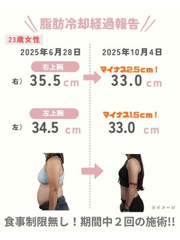 ココ(Coco)/二の腕／内もも／下腹部