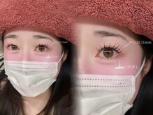 ウェヌス アイ ビューティ(VENUS eye beauty)/アンドヘルシー