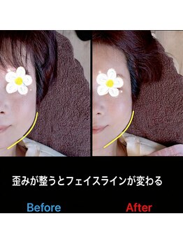 美容矯正サロン レレポノ(LELEPONO)/