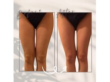 ヴィアス(VIAS)の雰囲気（太ももの隙間を作るのが得意です♪温熱で見た目にも変化が◎）