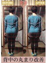 【小顔/リフトアップ/姿勢/骨盤矯正/頭蓋骨/痩身】ヴィオーデ美容整体サロン那覇店/小顔、リンパ、ヘッドスパ、骨盤