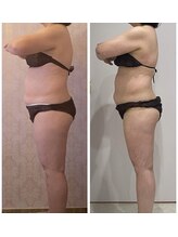 ルポーゼ(Repose)/