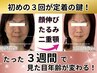 おすすめ【小顔3回+もう1回分】ご新規様限定★回数券◇￥72,000⇒￥60,000