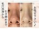 リヴェーヌ 呉羽店(Riverne)の写真/[黒ずみ/毛穴の詰まり/開き]セルフケアでは届かない毛穴汚れもマシンでごっそり☆プロにお任せ！
