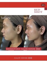 サロン 稲(SALON IIIINEE)/レッドショットよん！