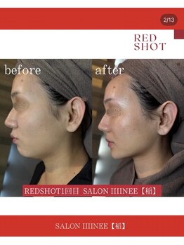 サロン 稲(SALON IIIINEE)/レッドショットよん!
