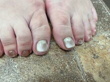 ネイルギャラリーアヴァン(NAIL GALLERY Avant)/マグネットフットネイル