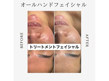 エース(Private Salon ace)の写真