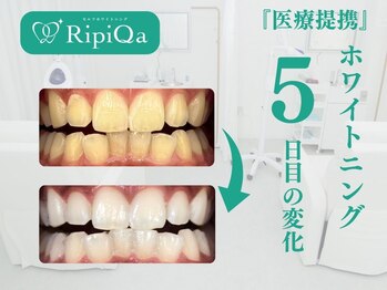 リピカ(RipiQa)/施術例