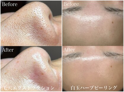 フレーズ(fraise)の写真