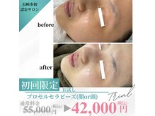 ヒルナム(Heal Nam)