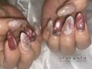 アミ施術お客様ネイル