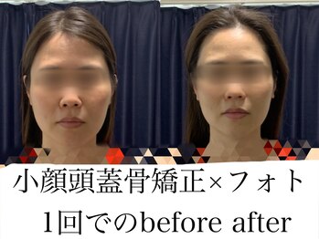 ロメリア(Roemeria)/お客様BeforeAfter