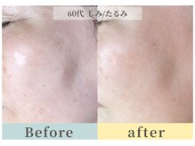 ムク(Muqu.)/正しいケアでどんどん変わるお肌