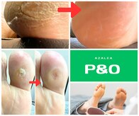 ピーアンドオー(P&O)