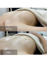 ルナリア ルクス 志木南口駅前店/バストケア＆バストアップ