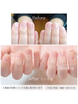 ネイルサロン ラピエトラ(la pietra)/最強のネイルケア3ケ月間コース