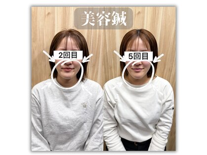 アークス(ARQS)の写真