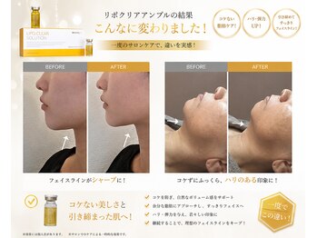 アルム(Areum)の写真/韓国発!脂肪ケア「クリアアンプル」で今年の夏は顎下たるみやフェイスラインをキュッと引き締め!