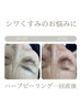 【肌質改善】毛穴コスメピーリング＋日本製幹細胞剥けないハーブピーリング