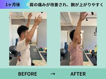 トミーリハ整体院(TOMMY REHA整体院)/肩の痛み改善