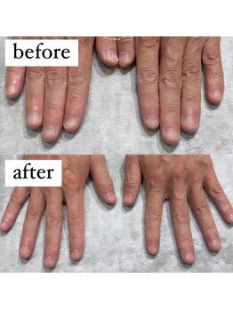 サムライビューティー 新宿三丁目店(SamuraiBeauty)/メンズクリアネイル