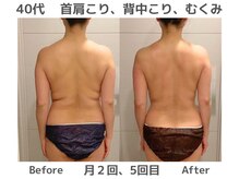 オーナーのゴットハンド痛いけど効く！浮腫みも解消！脱オバ体型