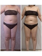 ルポーゼ(Repose)/