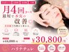【月4回コース/定額制/美容鍼/小顔】最短で本気の改善◎¥44,000→¥30,800/月