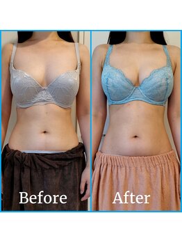 ティアラ(TIARA)/インスタ【@takara_tiara】