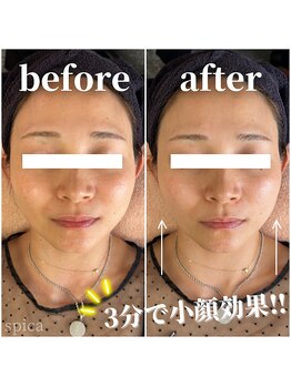 スピカ(Spica)/SNSで話題!テラボーラー☆