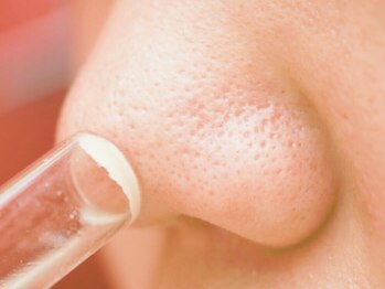 ノンノガーデン フォーネイル 札幌大通店(non-no garden for nail)/黒ずみ撃退！小鼻洗浄